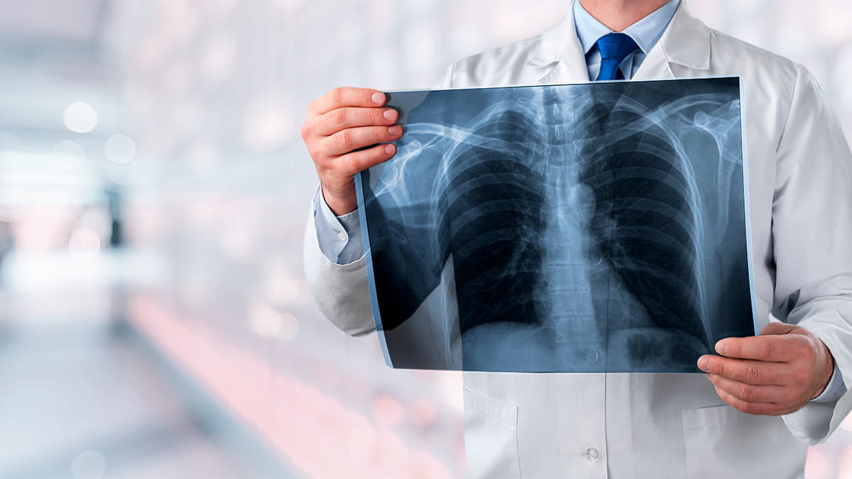 Prevenir el cáncer de pulmón: #Conversaciones sin Filtro